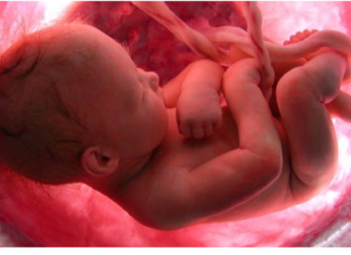 Un bebé nace con el anticonceptivo de su madre en la mano