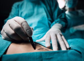 Aumentan muertes por cirugías de aumentos de glúteos