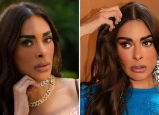 Galilea Montijo, confirma tuvo complicaciones después de que le tocaran un nervios durante un procedimiento estético